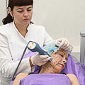 thermage лицо
